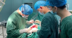 Mổ não khẩn cấp cứu bệnh nhân gặp tai nạn giao thông