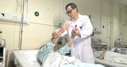 Phẫu thuật nội soi trên cung mày cắt bỏ u tầng trước nền sọ